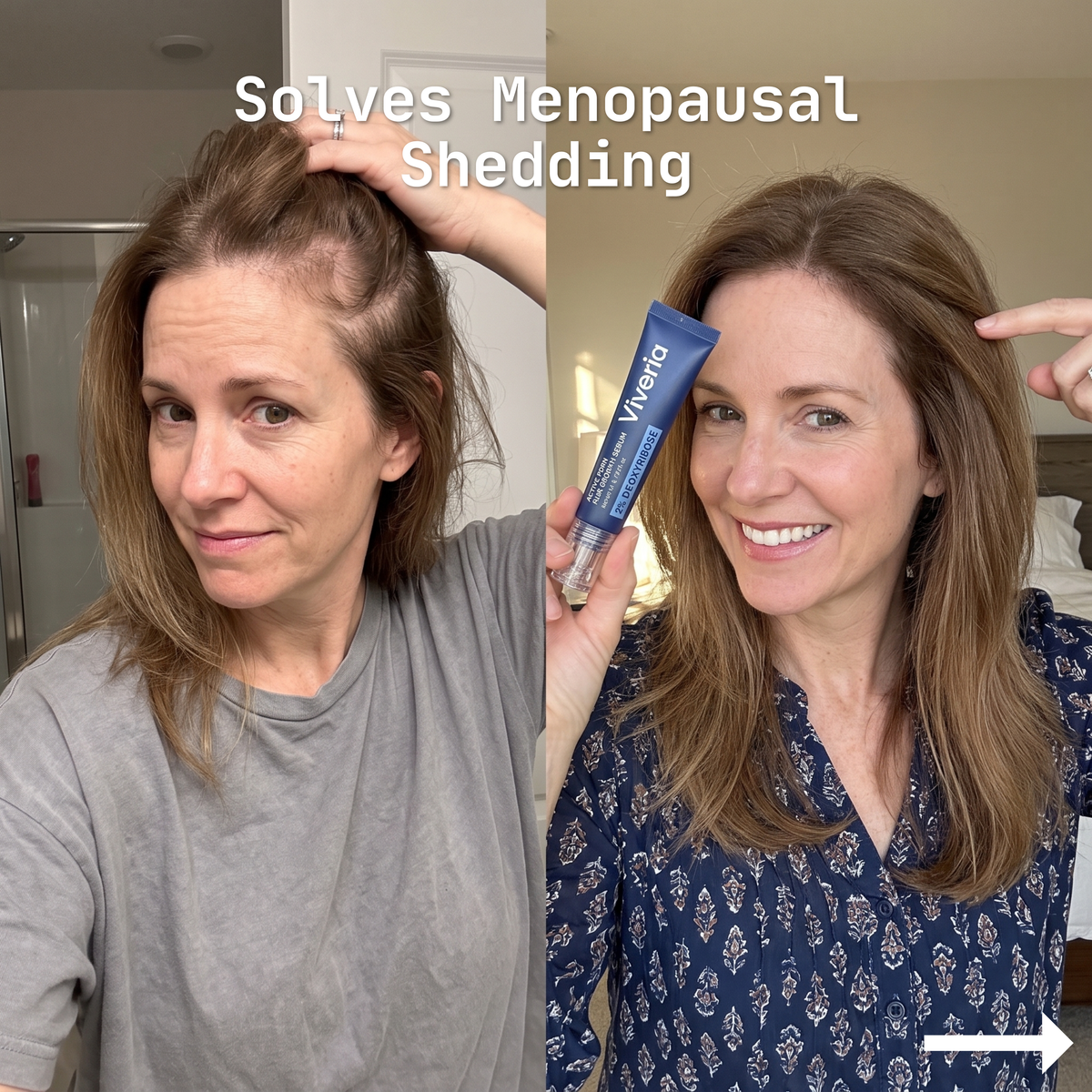 Viveria 2% Deoxyribose Hair Growth Serum