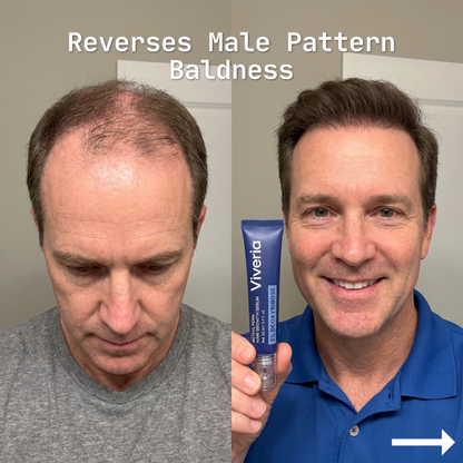 Viveria 2% Deoxyribose Hair Growth Serum