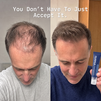 Viveria 2% Deoxyribose Hair Growth Serum