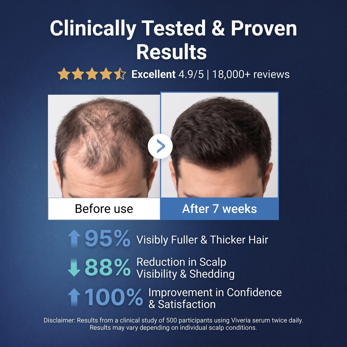 Viveria 2% Deoxyribose Hair Growth Serum